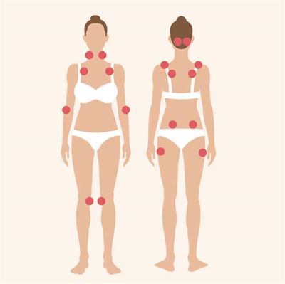 Fibromyalgi og overvægt: Sammenhængen og strategier til håndtering