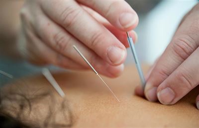 Akupunktur i Silkeborg - Effektiv lindring