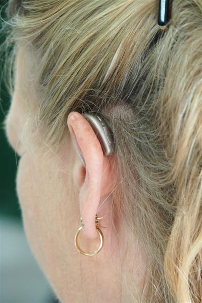 The Essential Guide to Phonak Hearing Aid Parts