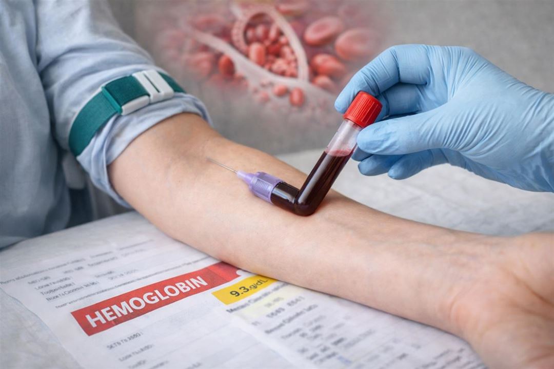 Hæmoglobin b lavt - hvad betyder det?