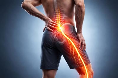 Iskiassmerter - Årsager, symptomer og behandling